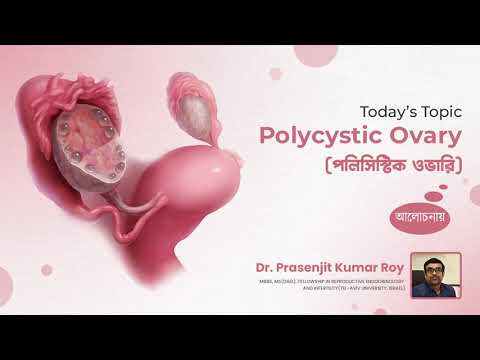 Polycystic Ovary