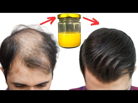 Hair grows quickly and doesn't fall out, that's the best way! 3 best recipes
