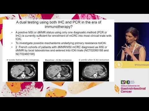 Hpv virus and mouth cancer