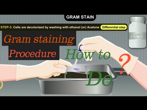 Gram staining procedure /animation