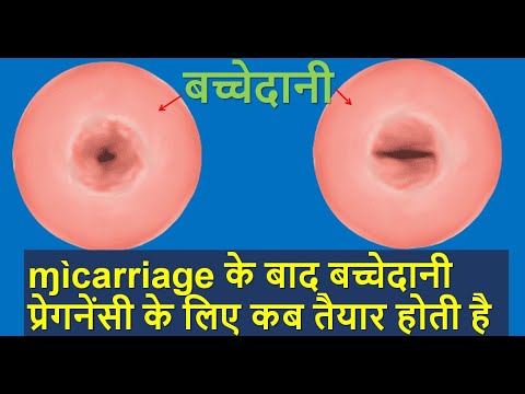 ɱìcarriage के बाद बच्चेदानी प्रेगनेंसी के लिए कब तैयार होती | pregnancy after Miscarriage | In Hindi