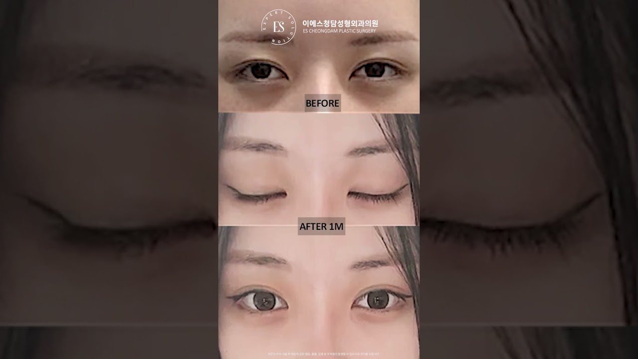 이에스 유튜브