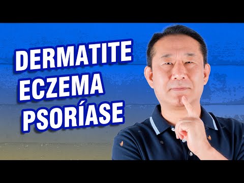 Nuovo unguento per cura di psoriasi Cura di psoriasi psorily