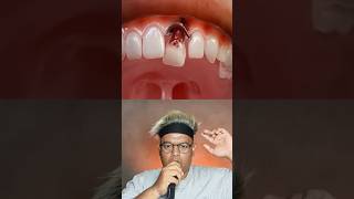 Download lagu GIGI MASUK PERUT βΌοΈ#shorts #subscribe #trending #collab mp3 Download lagu GIGI MASUK PERUT βΌοΈ#shorts #subscribe #trending #collab mp3