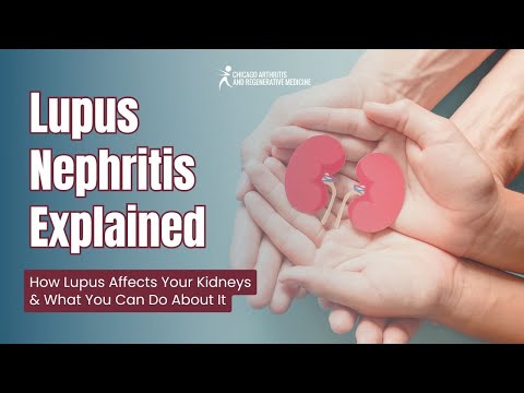 Lupus Nephritis Explained! How Lupus Affects Your Kidneys & What You Can Do About It