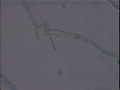 anabaena 