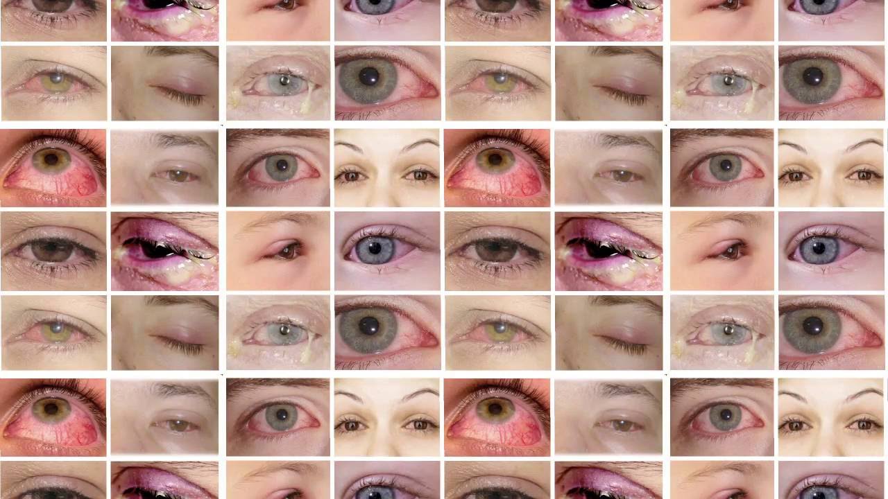 Ana Elisa Coimbra-42