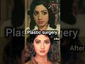 Shridevi Has Done 29 Plastic Surgeries To Look Beautiful Shorts Shridevi Plasticsurgery