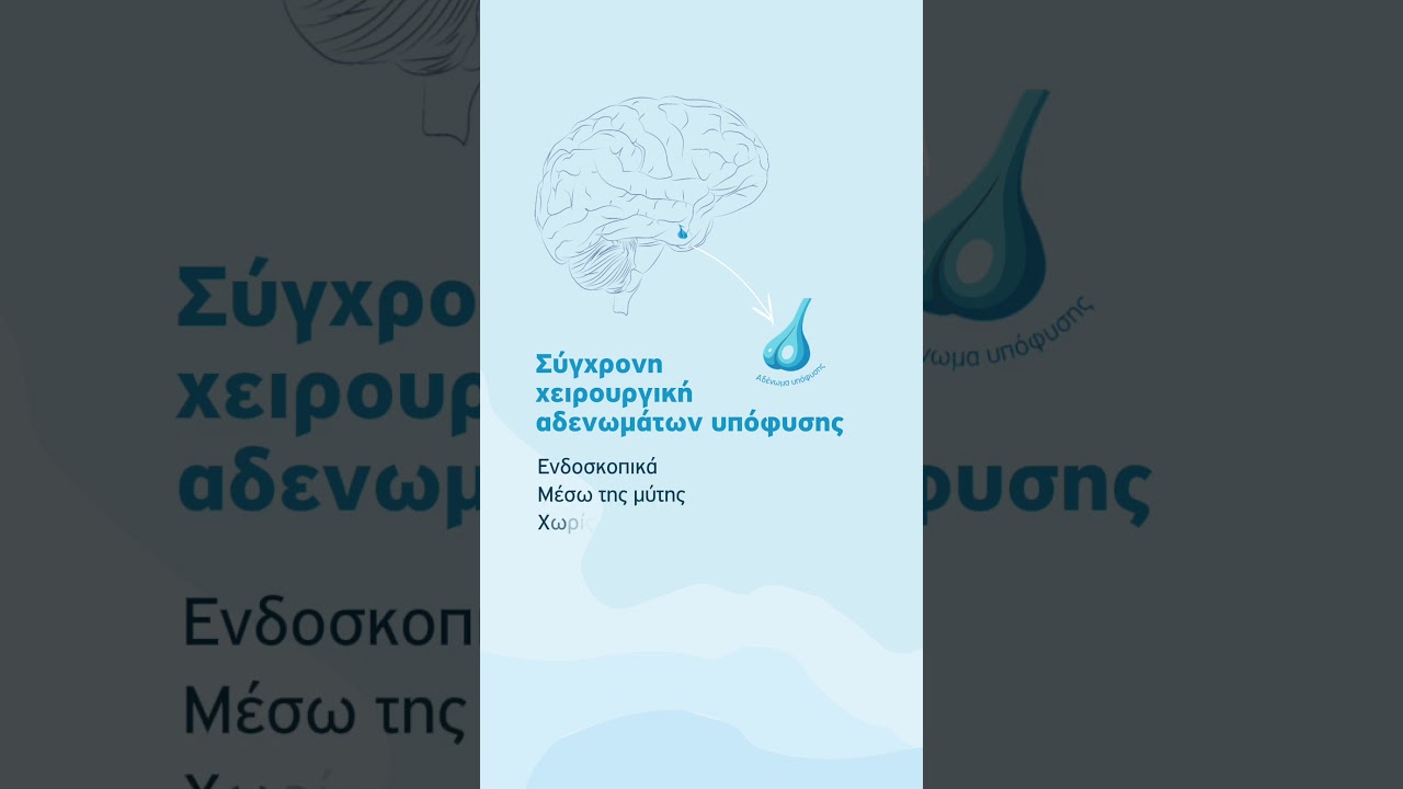 Αδενώματα Υπόφυσης: Μια πάθηση καλοήθης, αλλά όχι αθώα