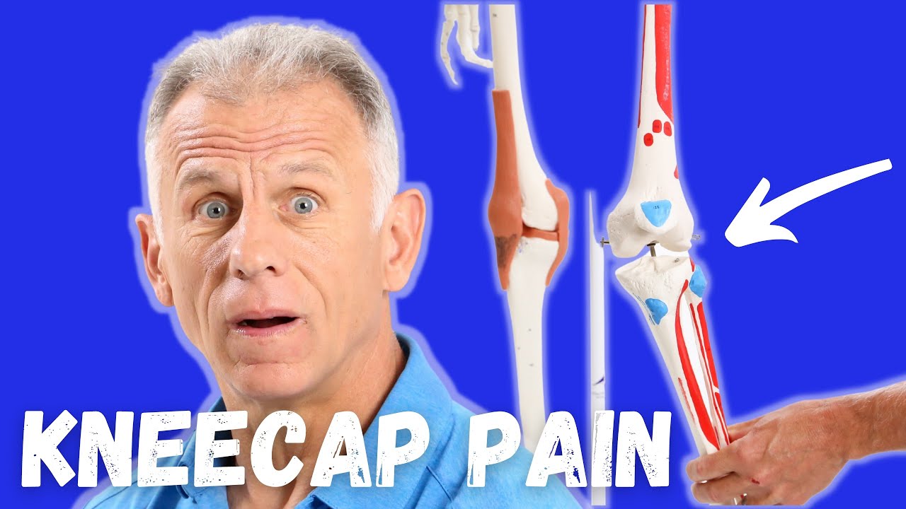 What is Causing Your Knee Pain? Patellofemoral Pain Syndrome or Kneecap Pain? How to Tell?