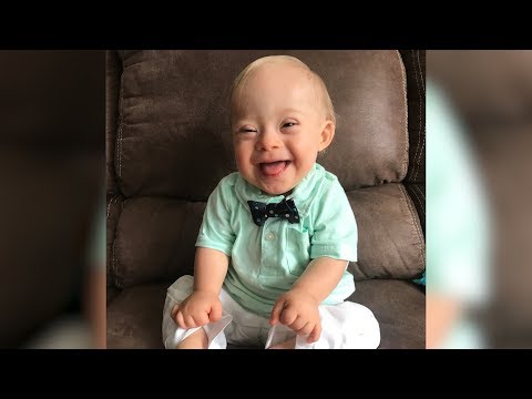 Veure vídeo 1-Year-Old Boy Becomes First Gerber Baby with Down Syndrome