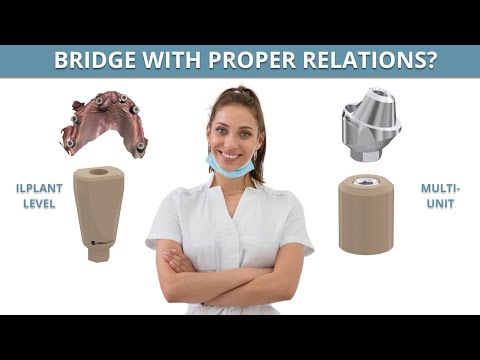 Prosthetics in dentistry | There were 4 dental implants, to which we added another 2 | All on four