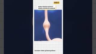 Download lagu You have to fart before you can eat. mp3