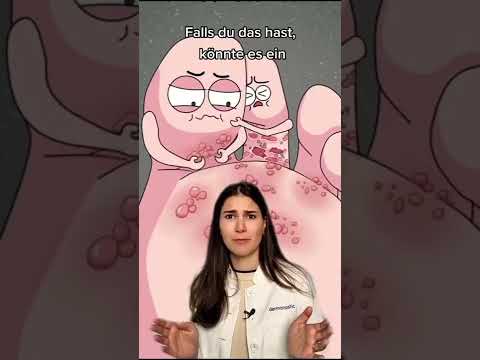 Itchy blisters on your feet? 😖│Dr. Alice Martin #shorts