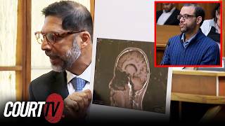 Triple Murderer’s Brain Damage Should Spare Him: Defense