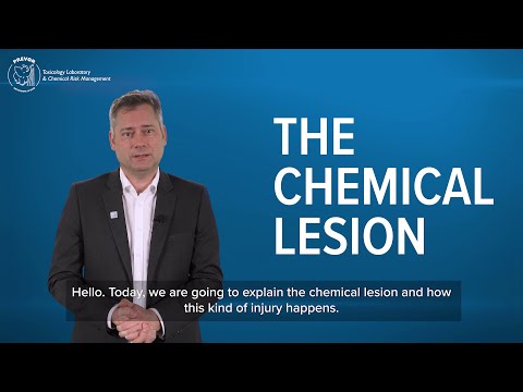 MICRO - 100ml Diphoterine Skin Spray - Chemical Burn