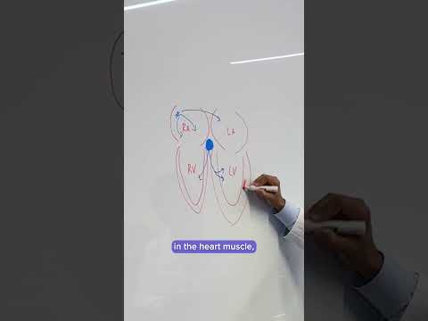 Ventricular Tachycardia