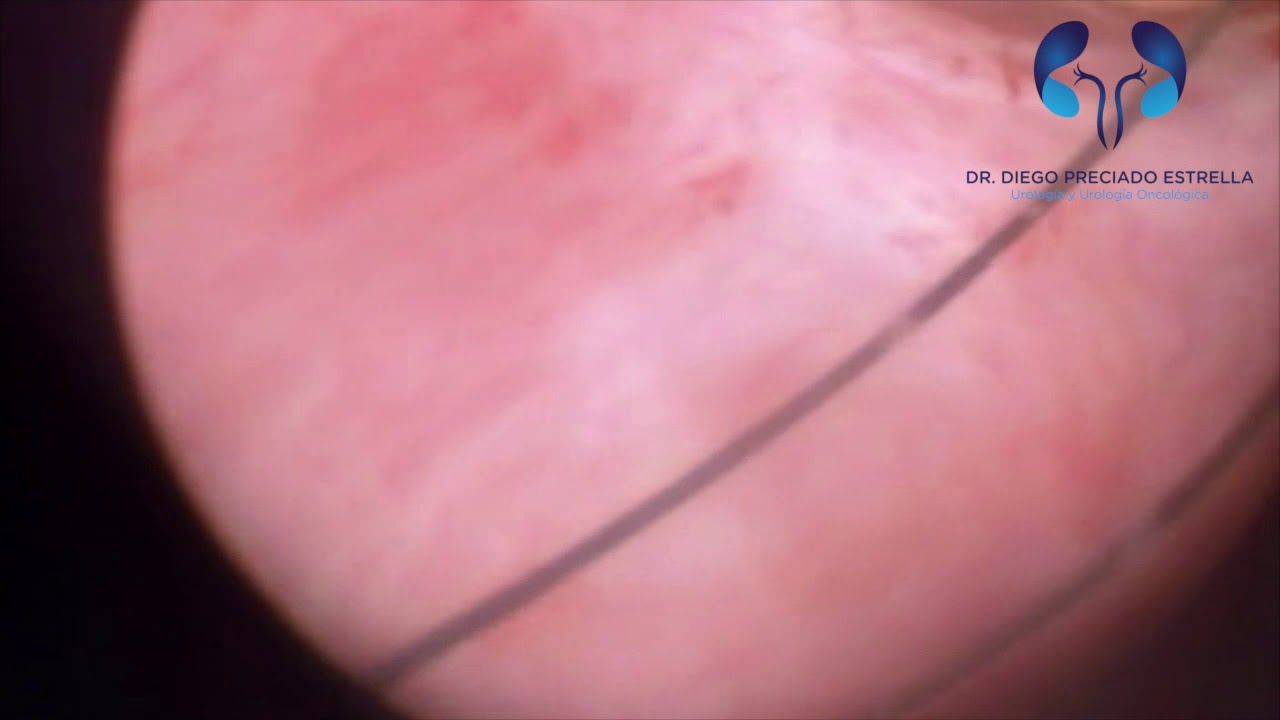 Diego Preciado Estrella-15