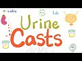 Urine casts (WBCs, RBCs, Waxy, Hyaline, Granular, Epithelial, Fatty)