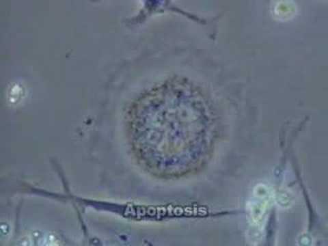 死はどのくらい最終的なものなのでしょうか?科学者が細胞死を止めることに成功