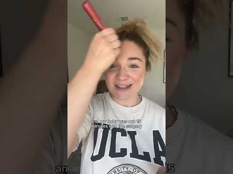 C-section vs vaginal delivery #shorts