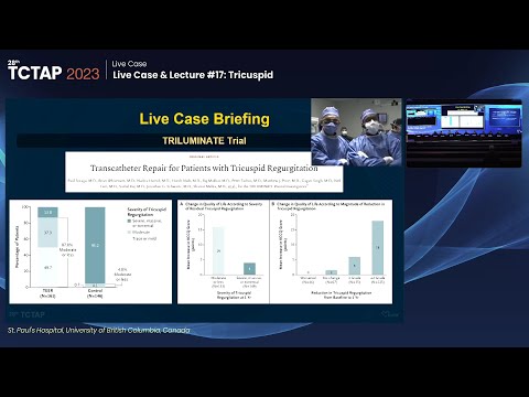 [TCTAP 2023] Live Case & Lecture #17: Tricuspid