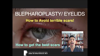 How to avoid terrible blepharoplasty/ eyelid scars. How to get the very best scars...