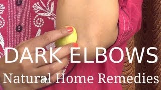Dark Elbows - Natural Home Remedies