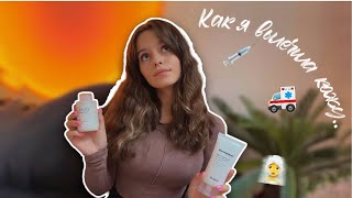 Вылечила прищи за месяц/ мои новинки уходовой косметики #какизбавитьсяотпрыщей