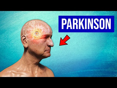 Maladie de Parkinson : Explication, Symptômes et Traitements