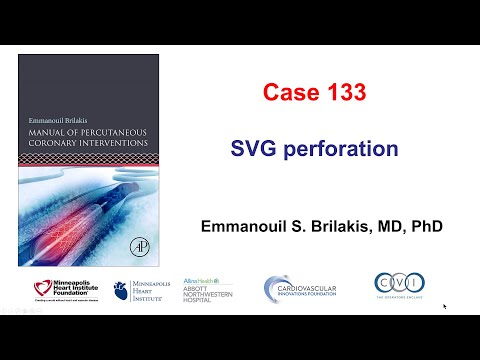 Case 133: Manual of PCI - SVG perforation