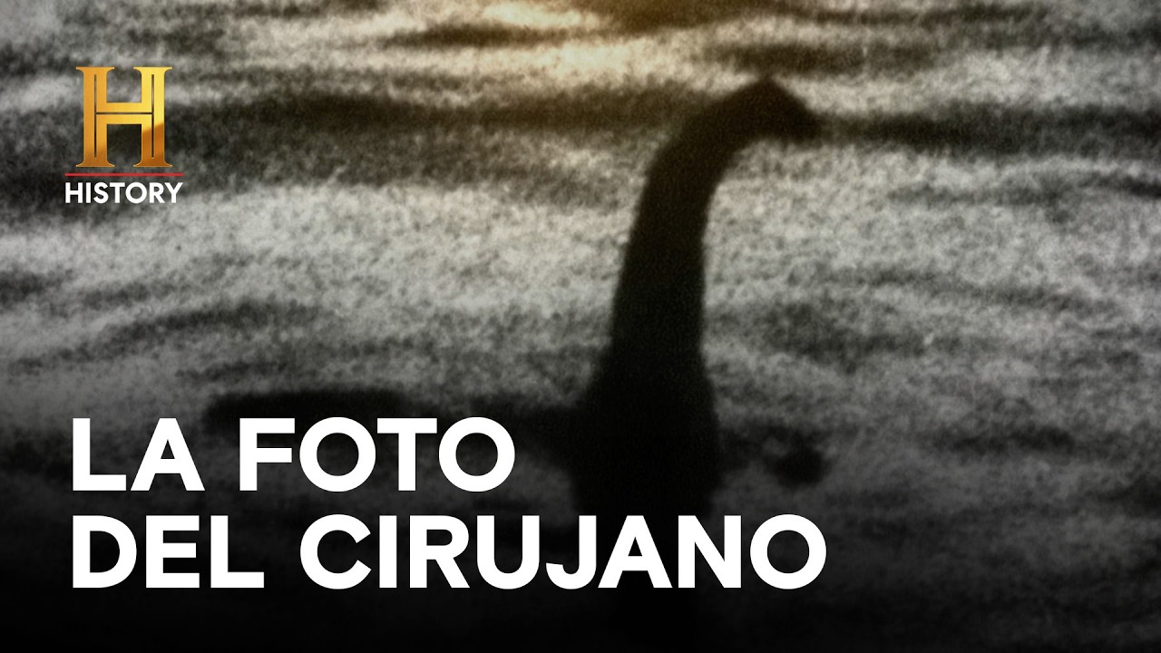LA FOTO DEL CIRUJANO  - GRANDES MISTERIOS DE LA HISTORIA