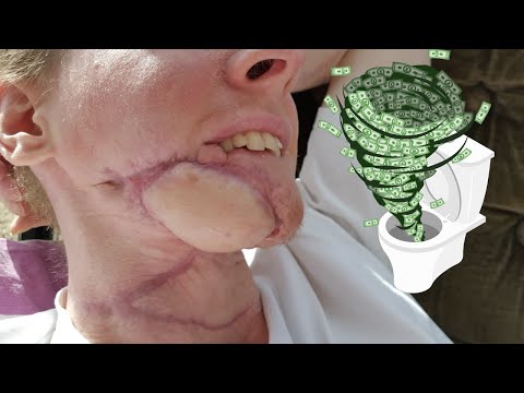 Cancer took all my money