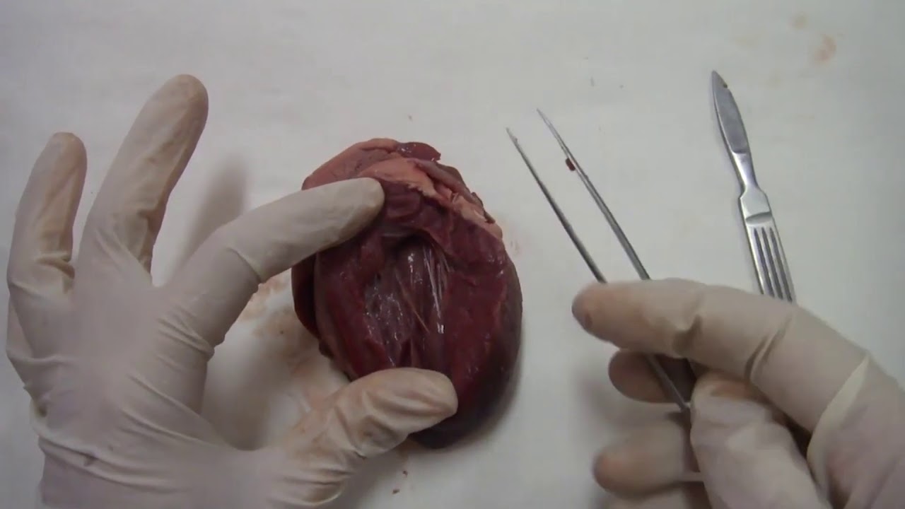 Prácticas de laboratorio. Disección del corazón.