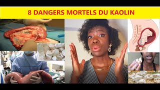 8 EFFETS NÉFASTES / MORTELS DU KAOLIN ! 😭😱😢 #NUTRITIONTV1
