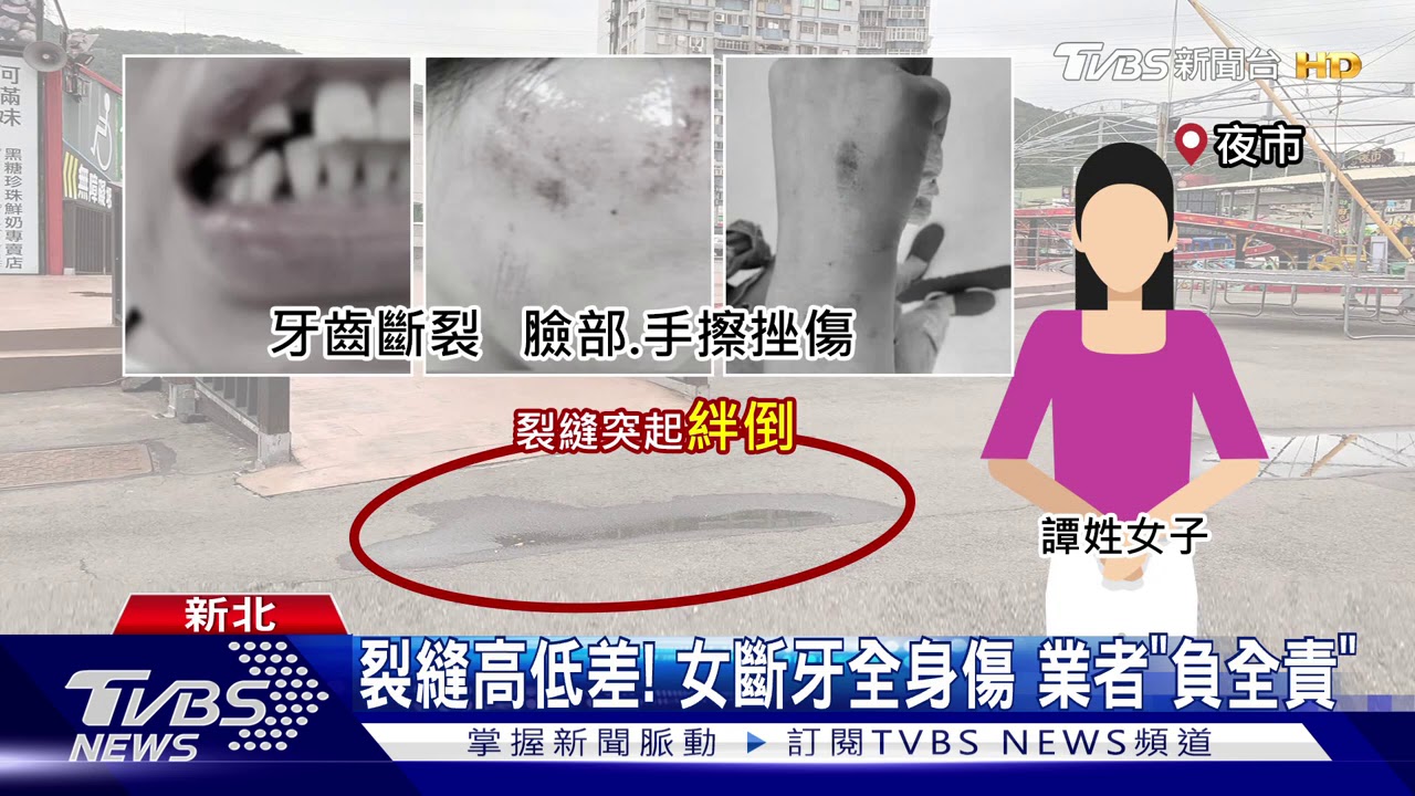 夜市裂縫害摔!女「斷牙」控業者撇責 業者駁:負全責