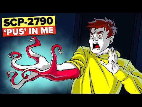 SCP-2790 You've got a squid in me