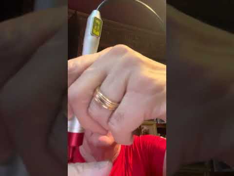 Dr. Zuckerman demonstrates How to treat Fungus Toe Nail with Remy Laser.