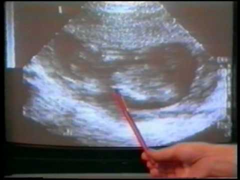 Che prendono per evitare articolazioni scricchiolanti Ferito due punti sul collo