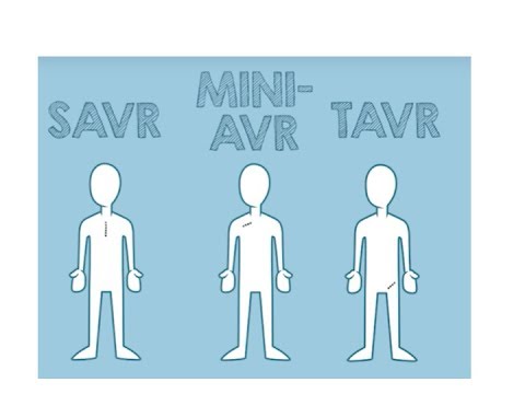 Aortic Stenosis: What are the treatment options?