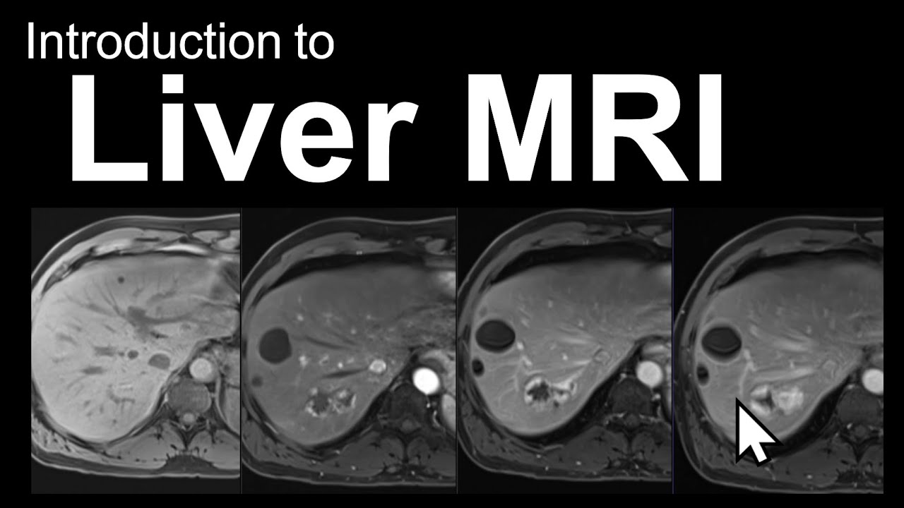 Introduction to Liver MRI: Approach and Case-Based Course