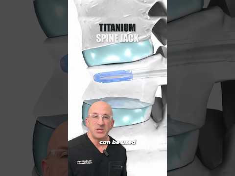 How Does a Spine Jack Fix a Broken Back?