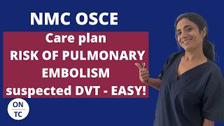 NMC OSCE – Super easy way to write RISK OF PULMONARY EMBOLISM care NEW 2026-suspected DVT scenario