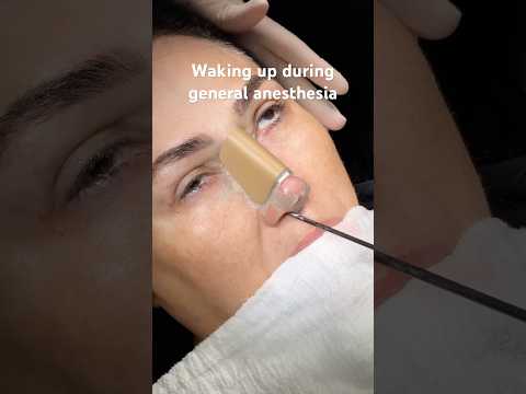 Anesthesia Isn’t Over Yet… But the Eyes Start Moving