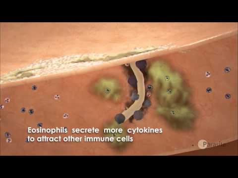 strongyloidosis széklet mit tehet a pinworm