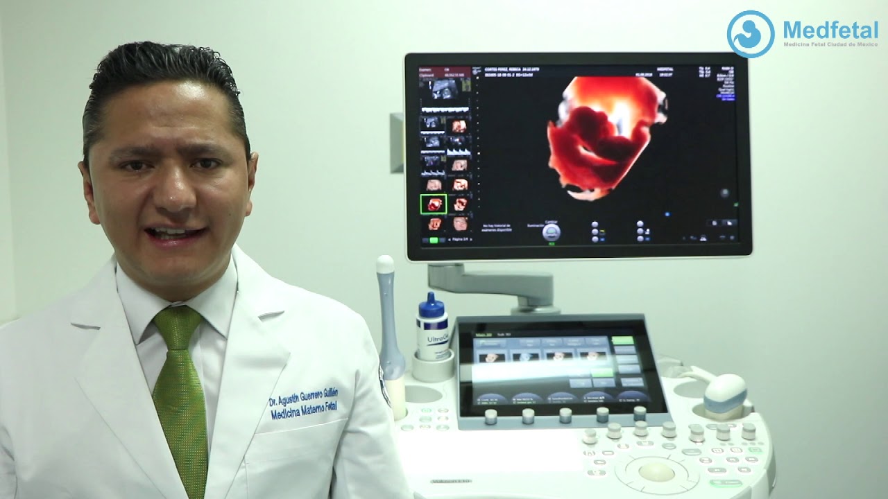 Agustin De Jesus Guerrero Guillen-14