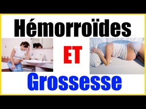 comment soulager hemorroides enceinte