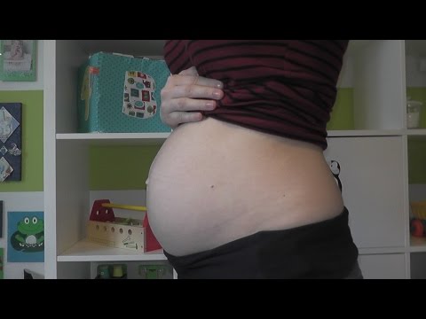 Symptome von Brust Osteochondrose, die ihm weh tut Die Verwendung von Pferdefett für Gelenke