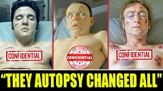 10 Shocking Autopsy Revelations From Singer Legends’ Deaths