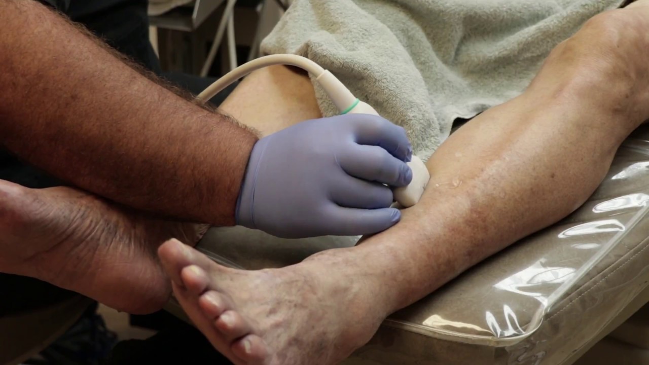 Yavapai Foot & Ankle Center Chats: What is a Vascular Technologist?